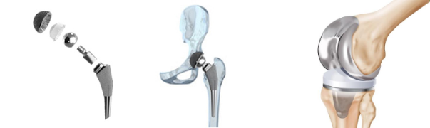 hip or knee joint grinding01