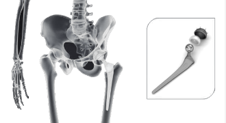 hip or knee joint grinding02.png
